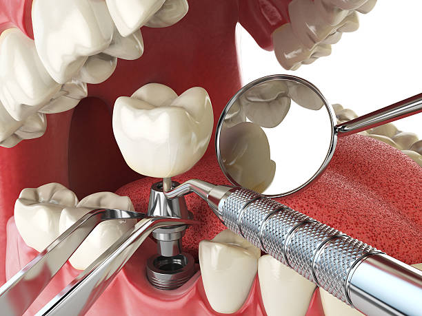 Tooth Infection Emergency Dentist in NC